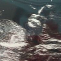 El consultorio de Lita para futuras mamis - 1