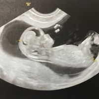 Futuras mamás Junio 2020 - 1