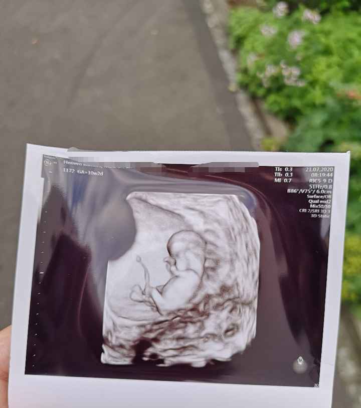 Futuras mamis Febrero 2021 - 1