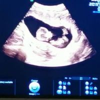 Futuras mamis Febrero 2021 - 1