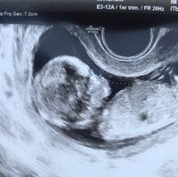 Futuras mamás Noviembre 2018! - 1