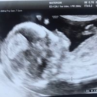 Futuras mamás Noviembre 2018! - 2