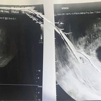 Futuras mamás Noviembre 2018! - 1
