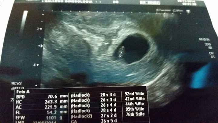 nuestro baby