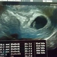 nuestro baby