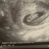 Futuras mamis junio 2021 🤰🏻❤️ oficial - 1