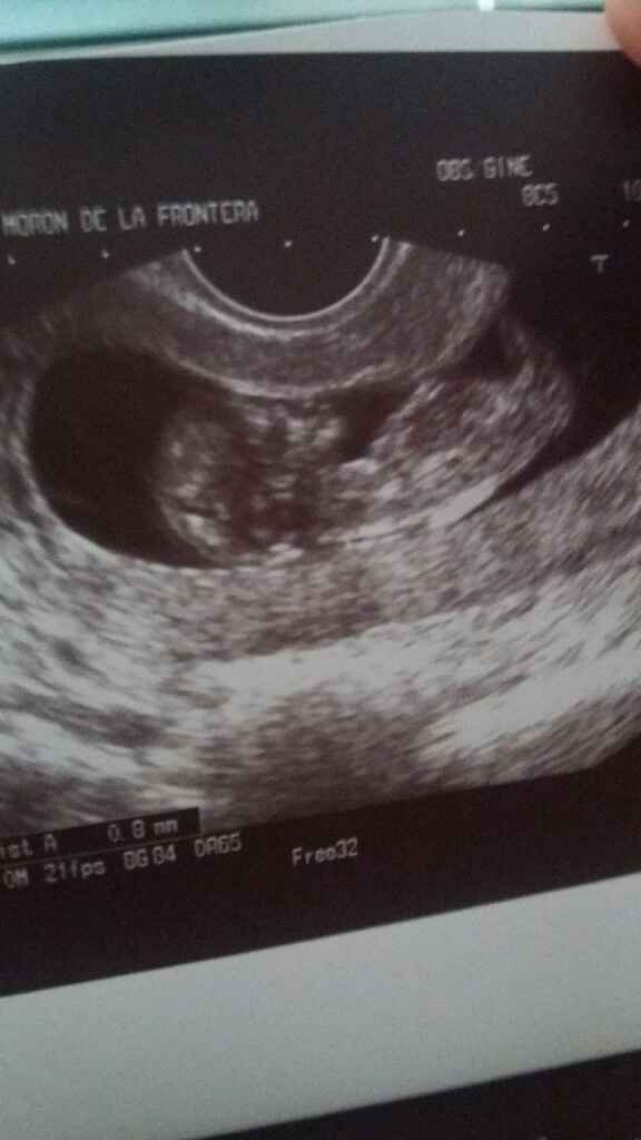 Que opináis de mi bebe niño  o niña - 1