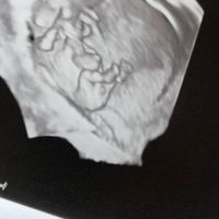 👶🏻futuras mamis febrero 2022👶🏻 - 1