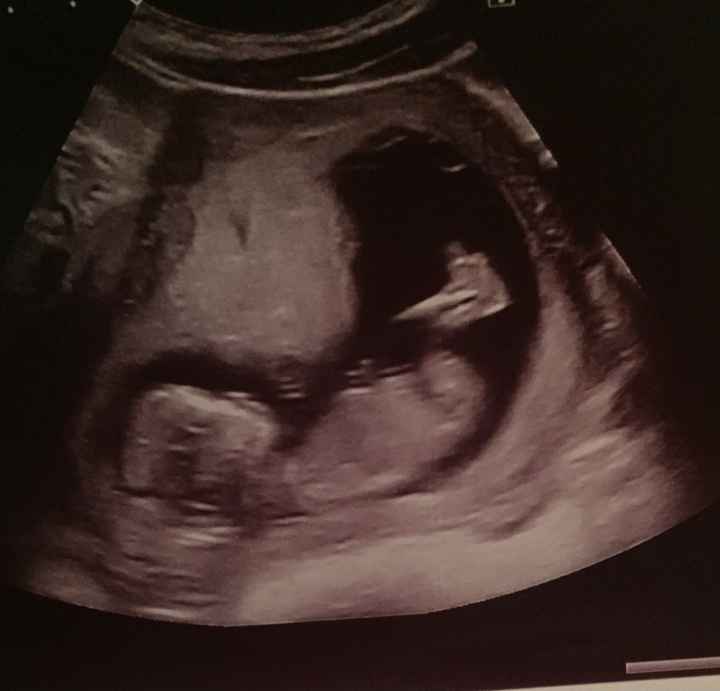 Futuras mamás Octubre 2018!!! - 1