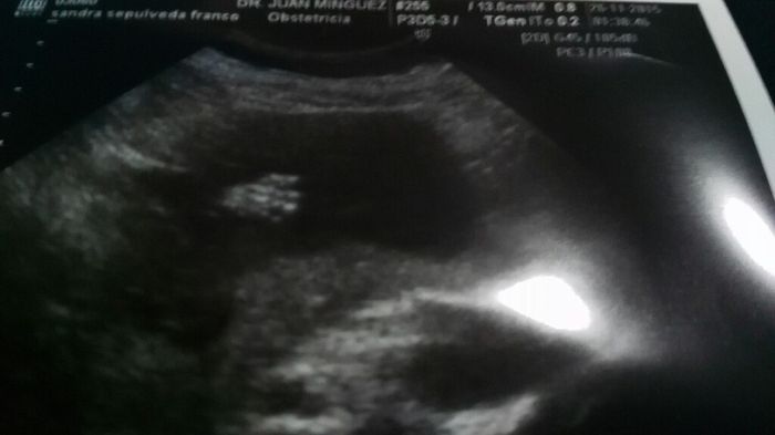 A mi si que me a tocado el gordo!! - 1