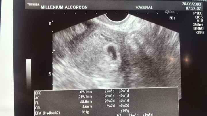 Futuras mamas febrero 2019 - 1