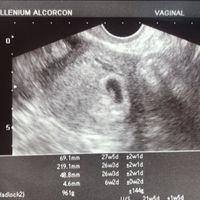 Futuras mamas febrero 2019 - 1