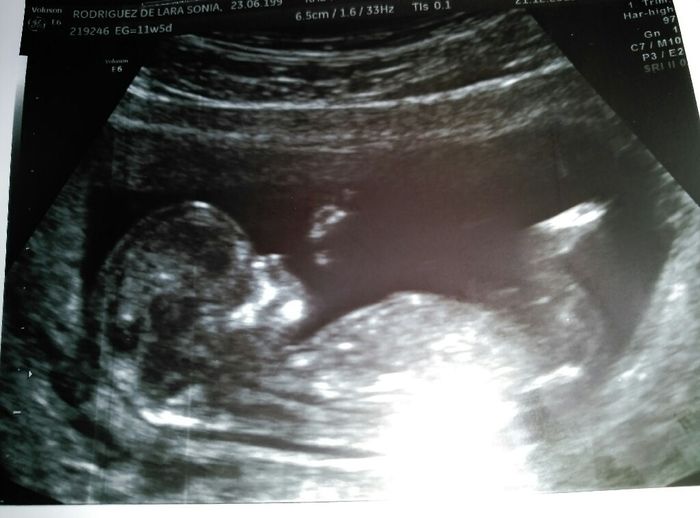 Futuras mamas julio 2016 - 1