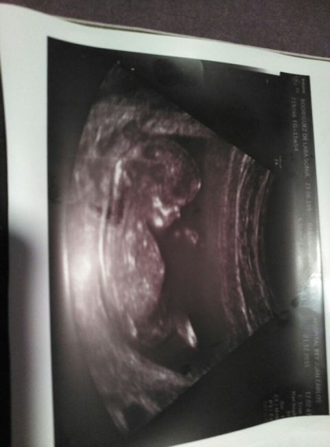 Futuras mamas julio 2016 - 2