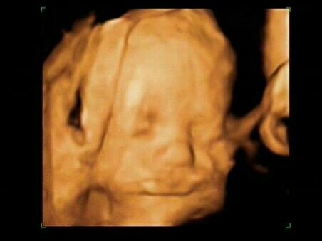 Futuras mamas julio 2016 - 1