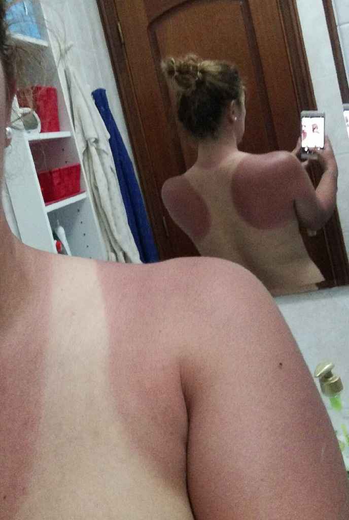 Cuidado con el sol - 1