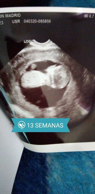 Ayuda con método ramzi: niño o niña? - 1