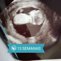 Ayuda con método ramzi: niño o niña? - 1