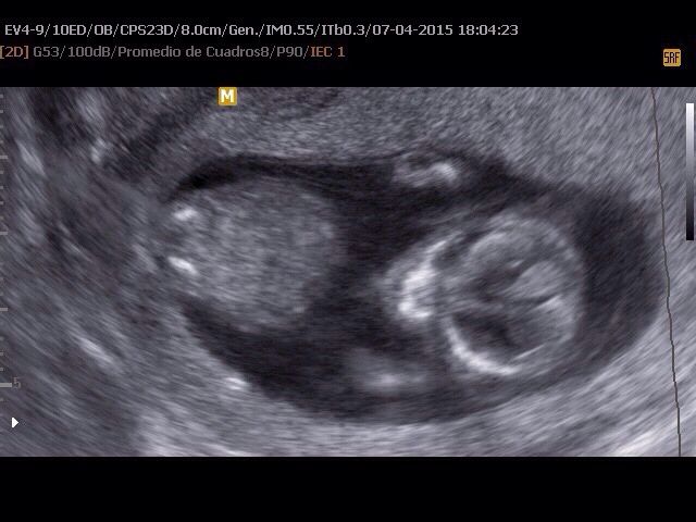 Mamas octubre 2015 - 2