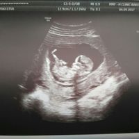 ¡nuevo! futuras mamis marzo 2018 - 1