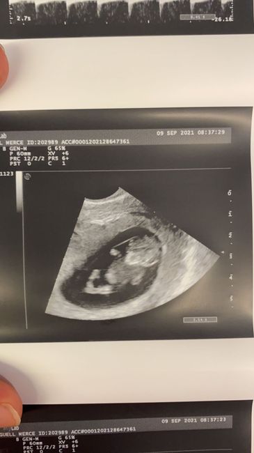 Futuras Mamis Abril 2022 🤰 1