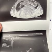 ¿Veis niño o niña? - 1