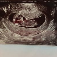 Futuras mamas julio 2016 - 1