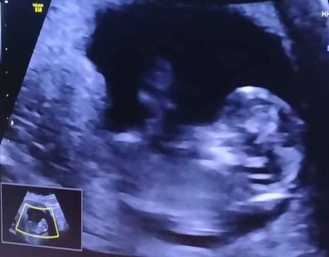 Futuras mamas octubre 2020 - 1