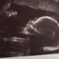 Futuras mamas octubre 2020 - 1