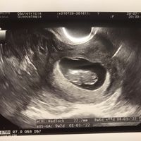 💞 Futuras Mamis marzo 22 🤰🏼 - 1