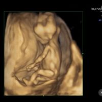 Futuras mamás agosto 2023 - 1