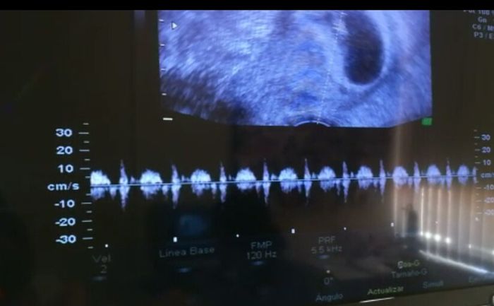 Futuras mamás marzo 2019 - 1
