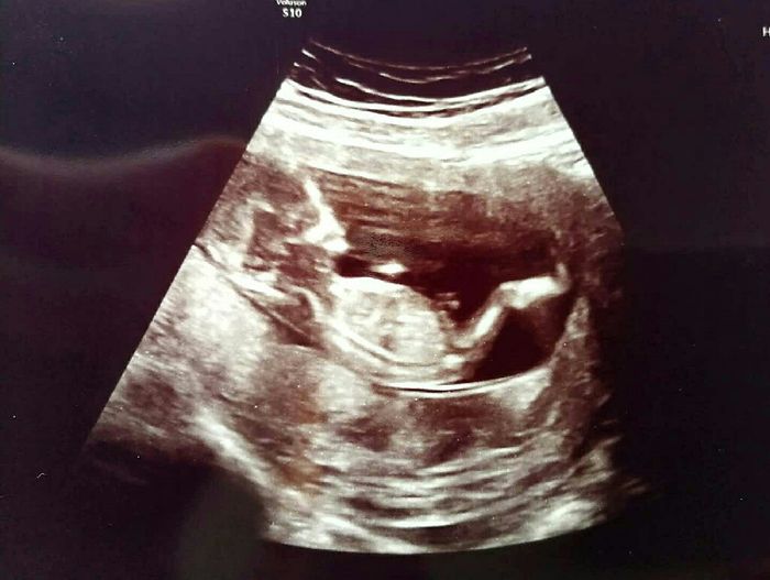Futuras mamás marzo 2019 - 2