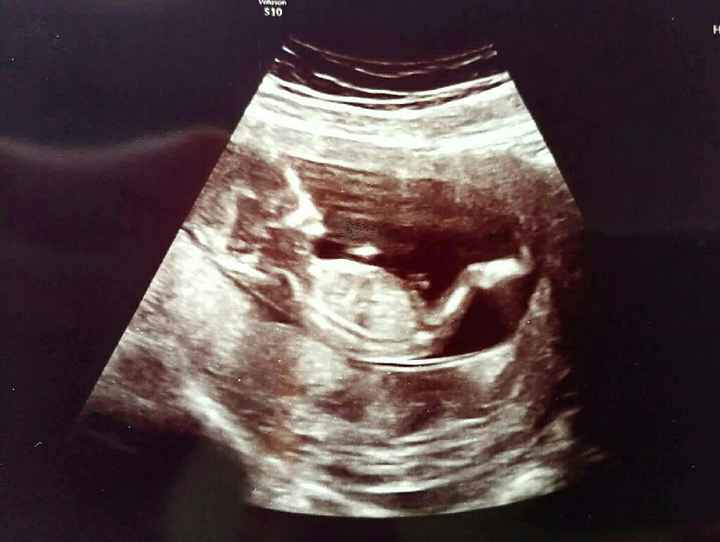 Futuras mamás marzo 2019 - 2