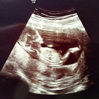 Futuras mamás marzo 2019 - 2