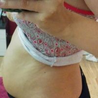 tripa 12 semanas