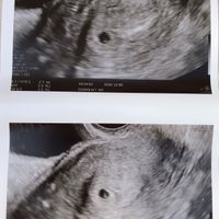 Futuras mamis Marzo 2021 ❤️❤️ - 1