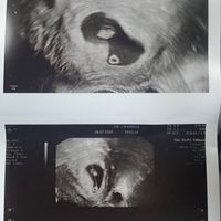 Futuras mamis Marzo 2021 ❤️❤️ - 1