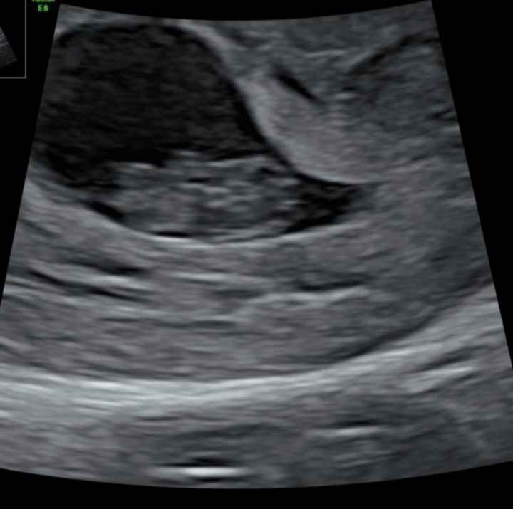 Ayuda para adivinar sexo bebe - 1