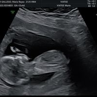 Alguien sabe identificar el sexo del bebe según el tubérculo? - 1