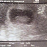 Ayuda con método ramzi: niño o niña? - 2