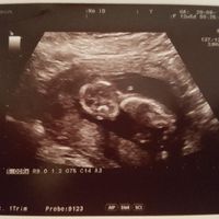 ¡nuevo! futuras mamis marzo 2018 - 1