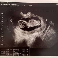 eco 12+3 y super bebe