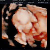 Mamis Marzo 2025 - 1