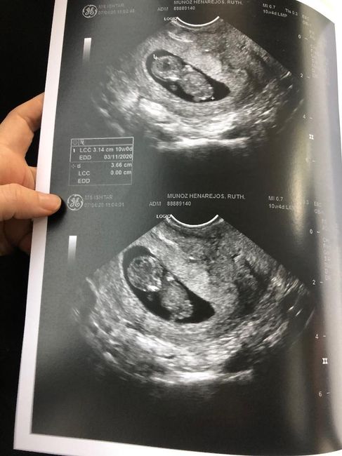 Futuras mamas octubre 2020 - 1