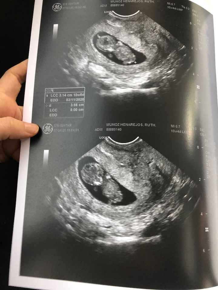 Futuras mamas octubre 2020 - 1