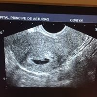 Ayuda con método ramzi: niño o niña? - 1