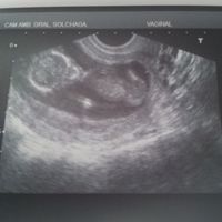 12 semanas!