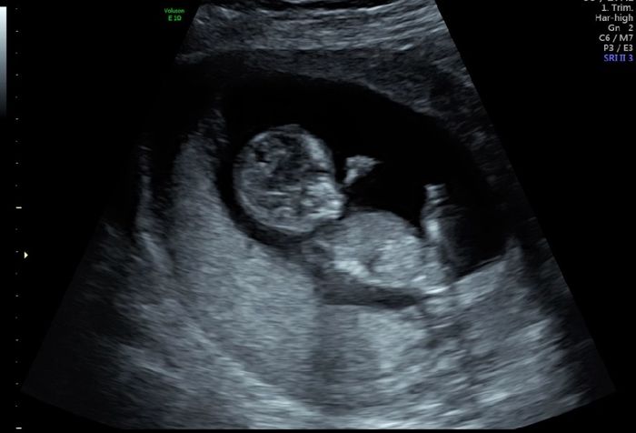 Futuras mamás septiembre 2019 - 1
