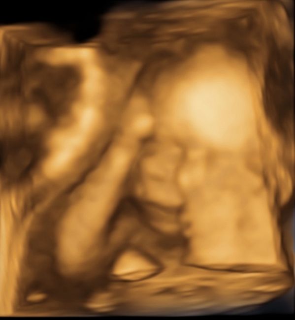 Futuras mamás septiembre 2019 - 1